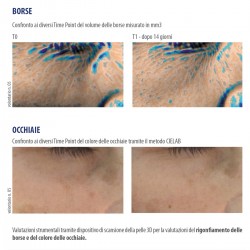 Ireos Siero Gel Liftante Illuminante Antiborse Antiocchiaie Helan